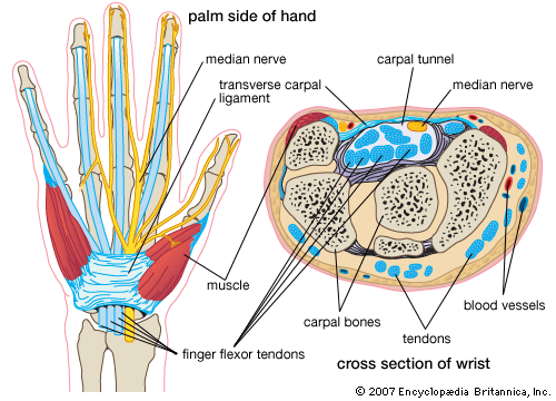 carpal tunnel syndrome.gif